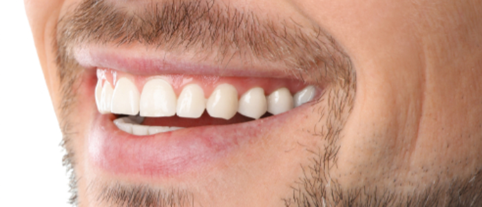 Close-up of a smiling man's mouth showcasing bright, healthy teeth, demonstrating effective dental treatment results from Harborside Dental.