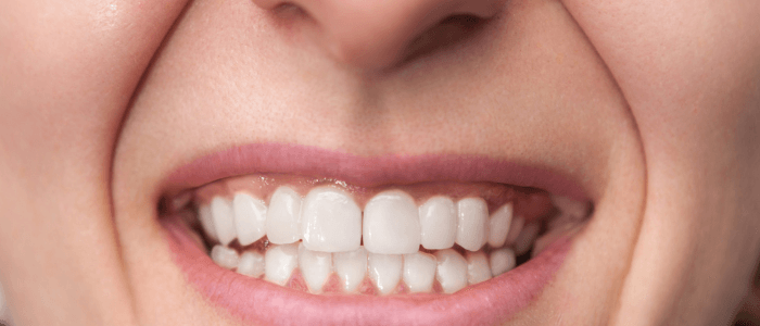 Close-up of a smiling person showcasing bright, white teeth, highlighting the results of effective dental treatments at Harborside Dental.