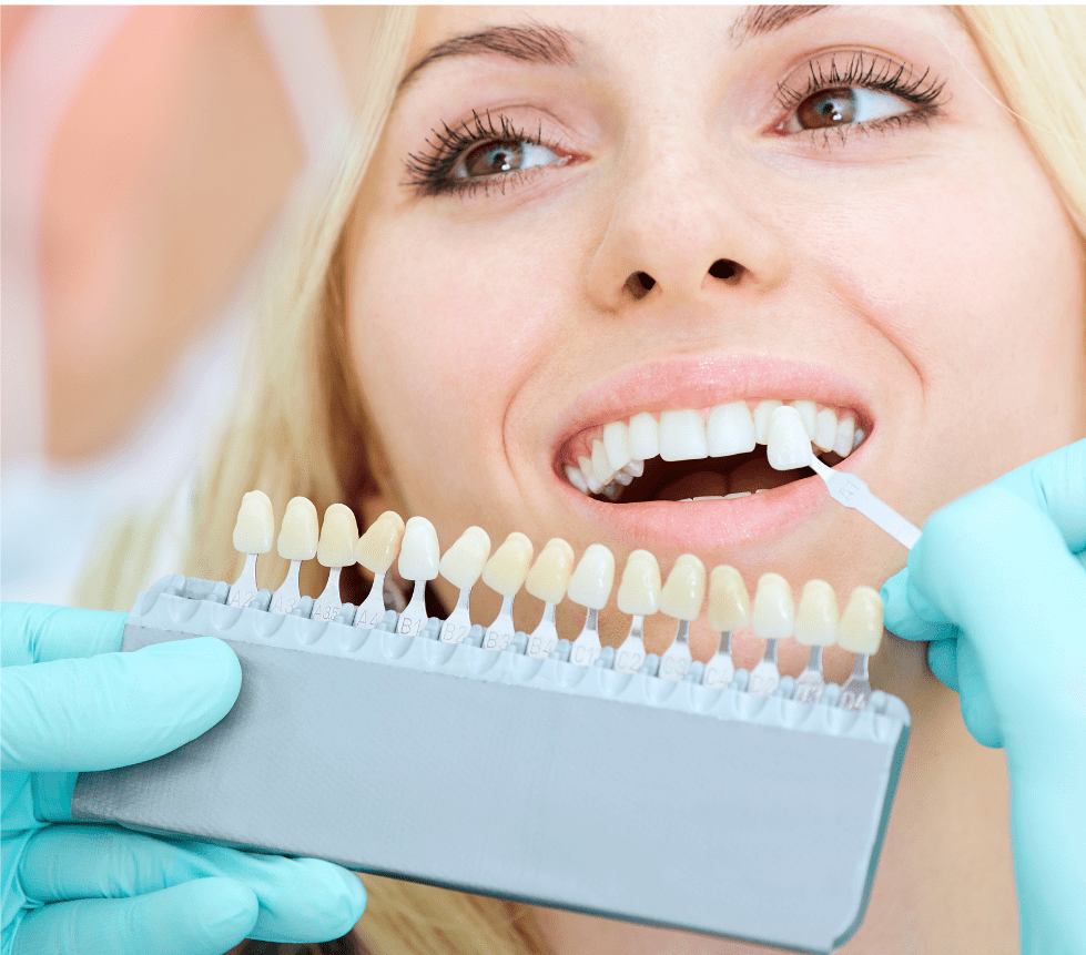 Woman smiling as dental professional compares tooth shade with dental crown color guide for restorative treatment.