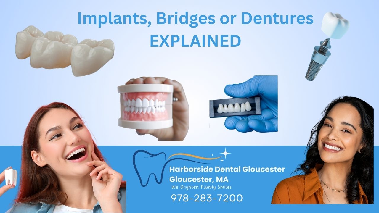 Dental implants, bridges, and dentures displayed with smiling individuals, dental models, and a dental implant, emphasizing restorative dentistry services at Harborside Dental in Gloucester, MA.